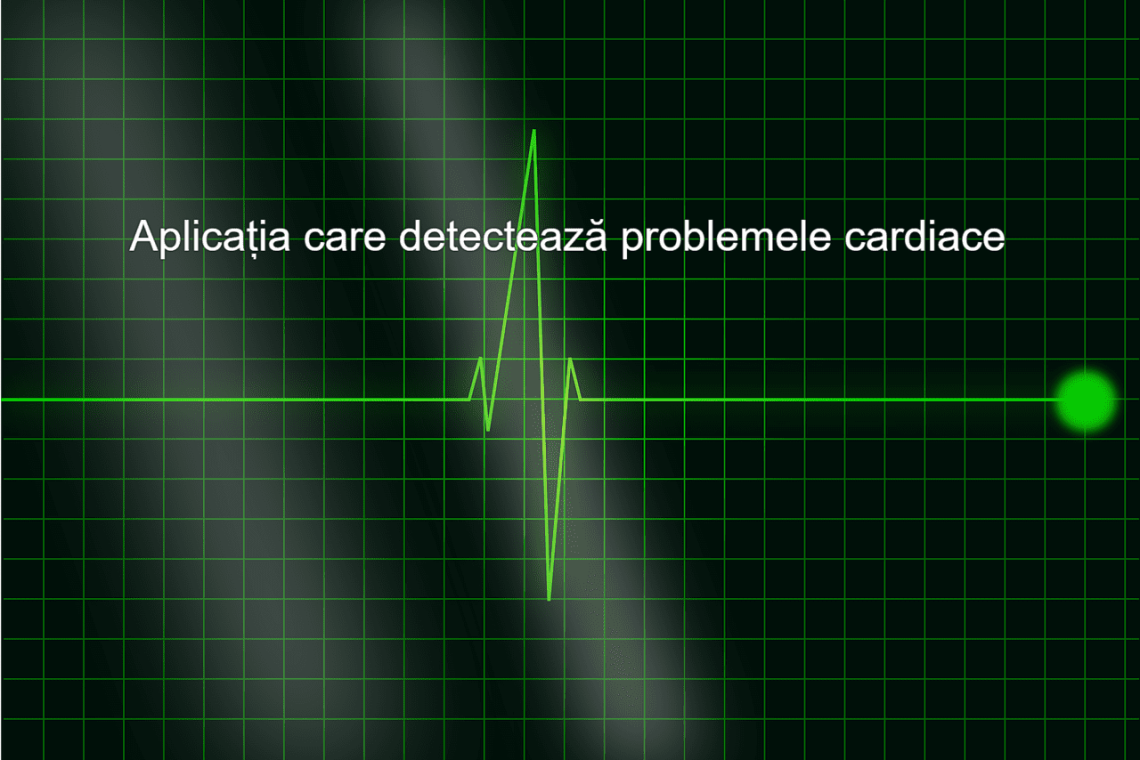 YALE: Au dezvoltat o aplicație care detectează tulburările cardiace din fotografiile ECG!